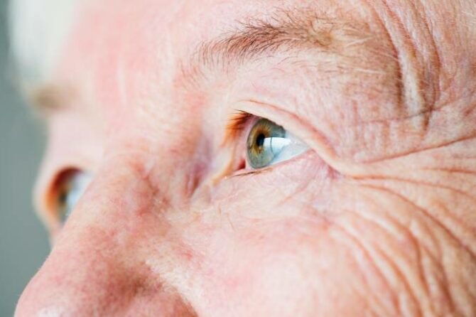 Blépharoplastie inférieure : traiter les poches et l&rsquo;excès de peau sous les yeux